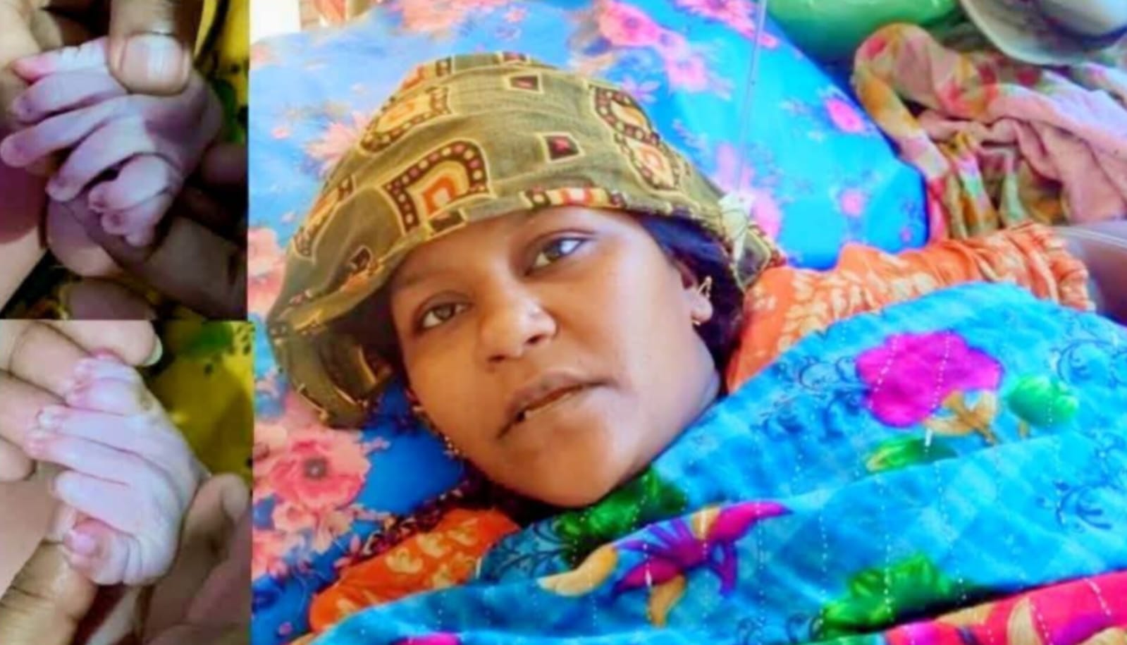 মঠবাড়িয়ায় ৩০টি আঙুল নিয়ে জন্ম নেওয়া সেই নবজাতকের মৃত্যু